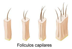 Unidad folicular para trasplante
